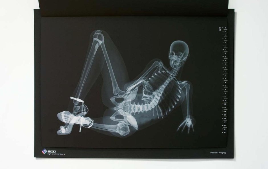 Прикольные рентген снимки