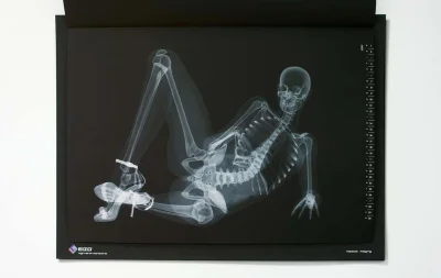 Прикольные рентген снимки