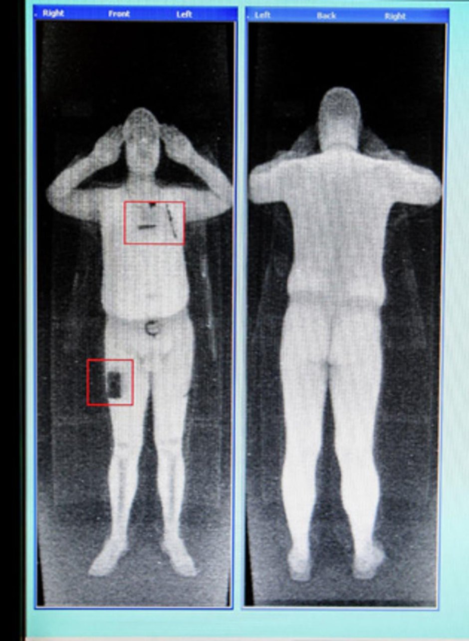 Сканер в аэропорту