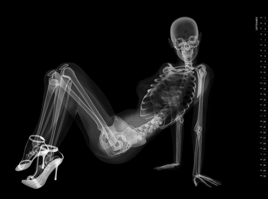 Рентген скелета