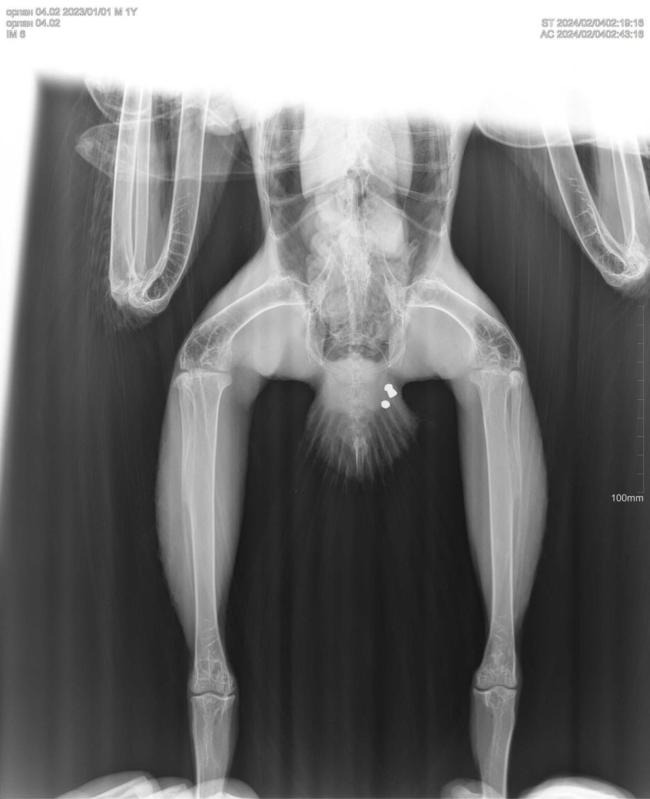Снимок на рентгене широкая кость