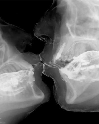 Порно рентген