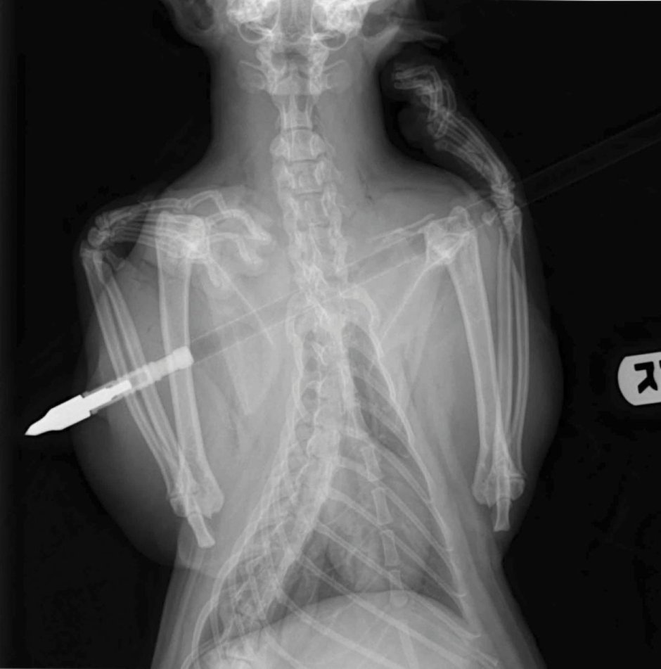 Что такое рентген