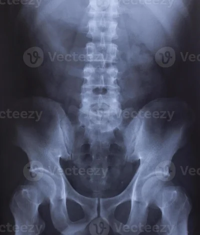 Рентген таза и позвоночника