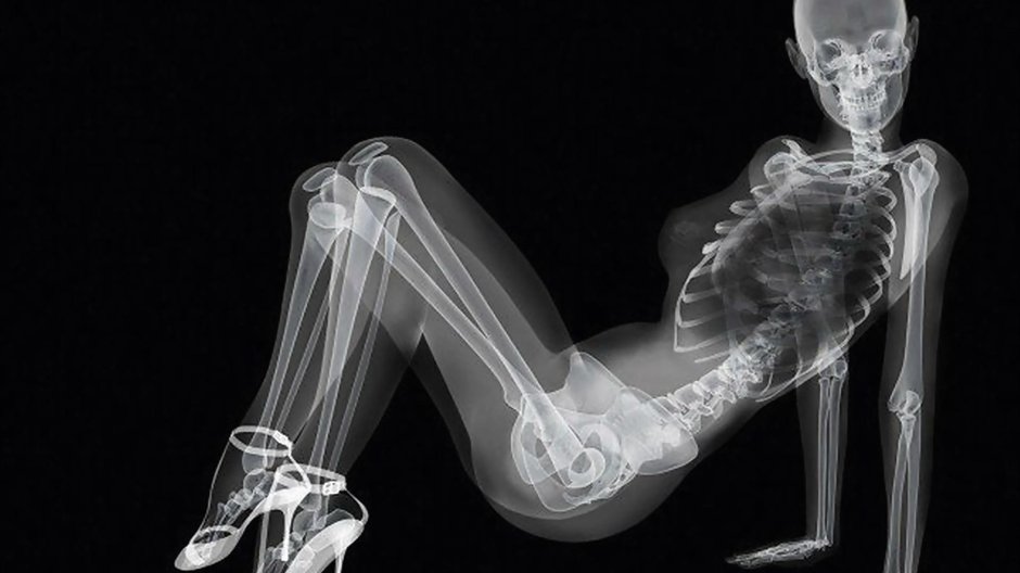 Рентгеновский снимок скелета