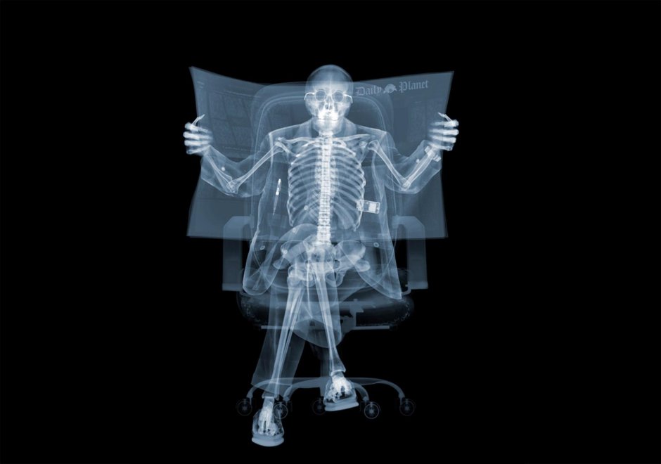 Скелет человека рентген