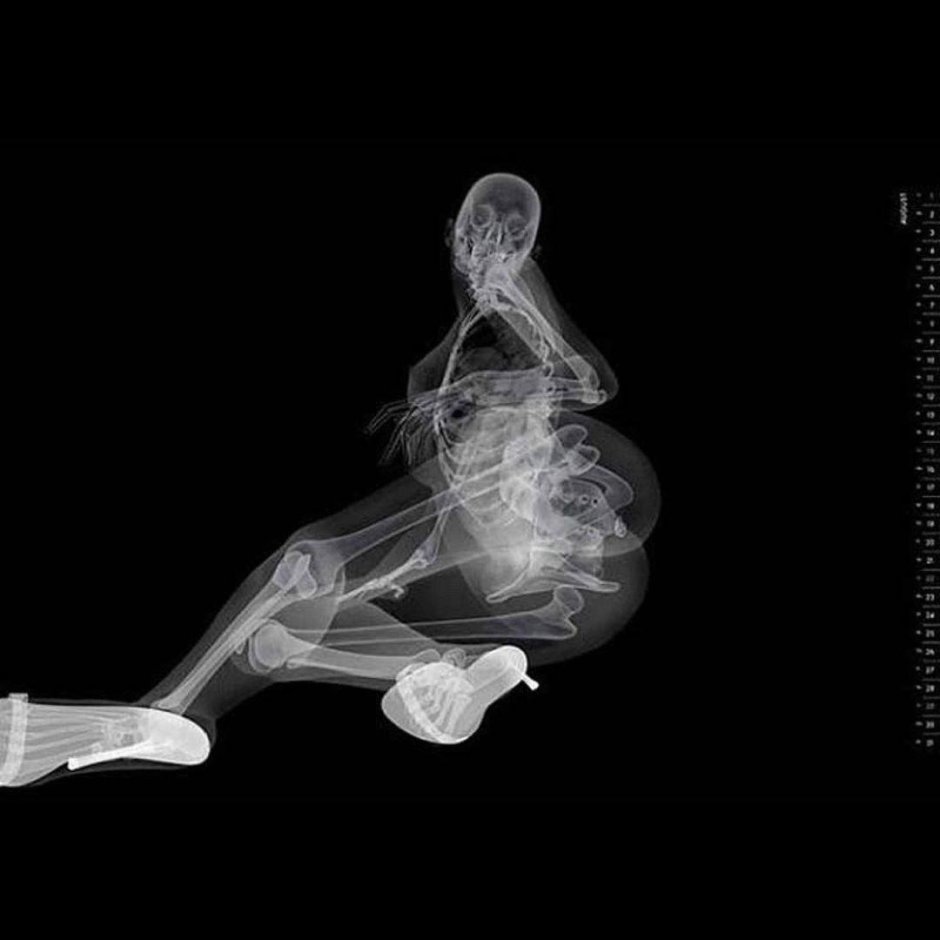 Смешные рентгеновские снимки