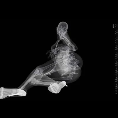 Смешные рентгеновские снимки