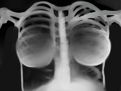 Грудная клетка рентген