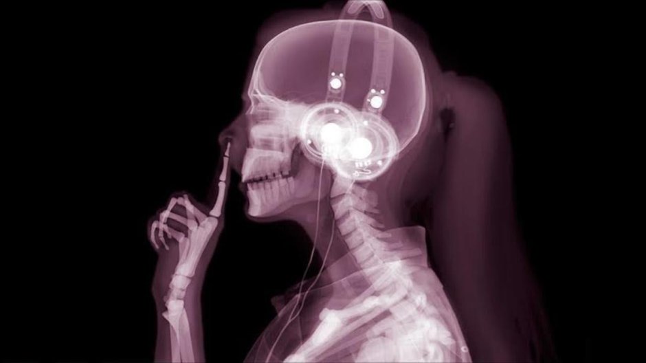 Рентген череп