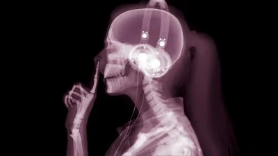 Рентген череп