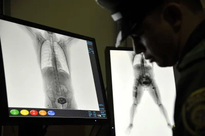 Рентгеновский сканер в аэропорту снимки