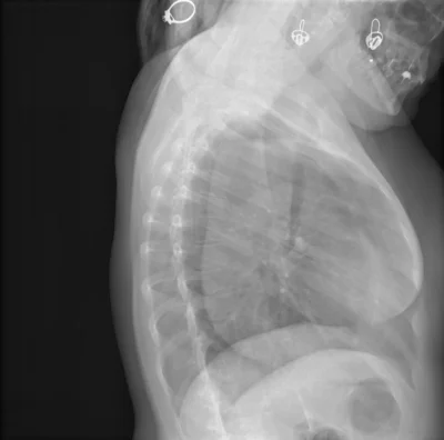 Рентген грудной клетки собаки норма