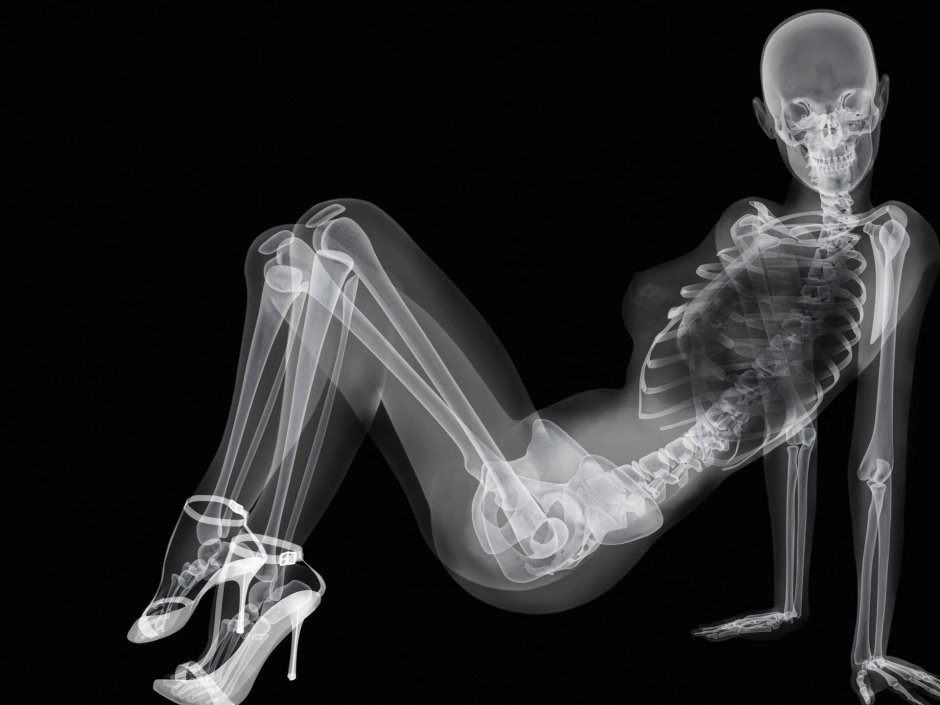 Рентген женского тела