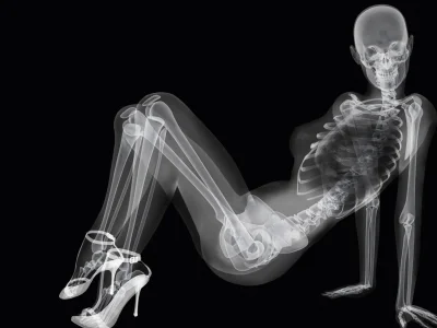 Рентген женского тела