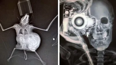 Необычный рентгеновский снимок