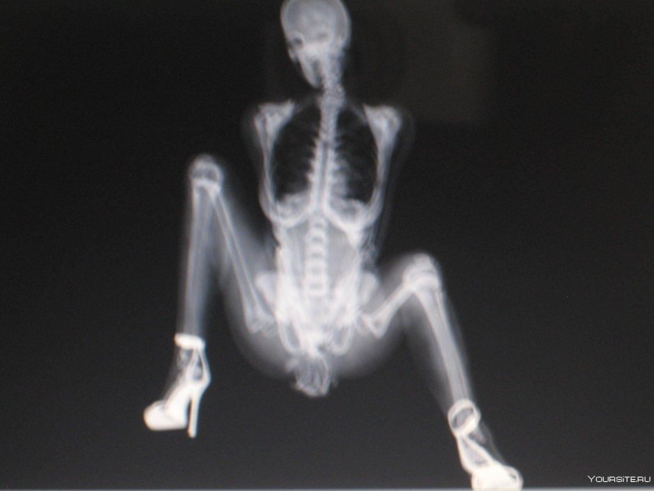 Рентгеновские снимки женщин