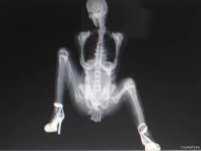 Рентгеновские снимки женщин