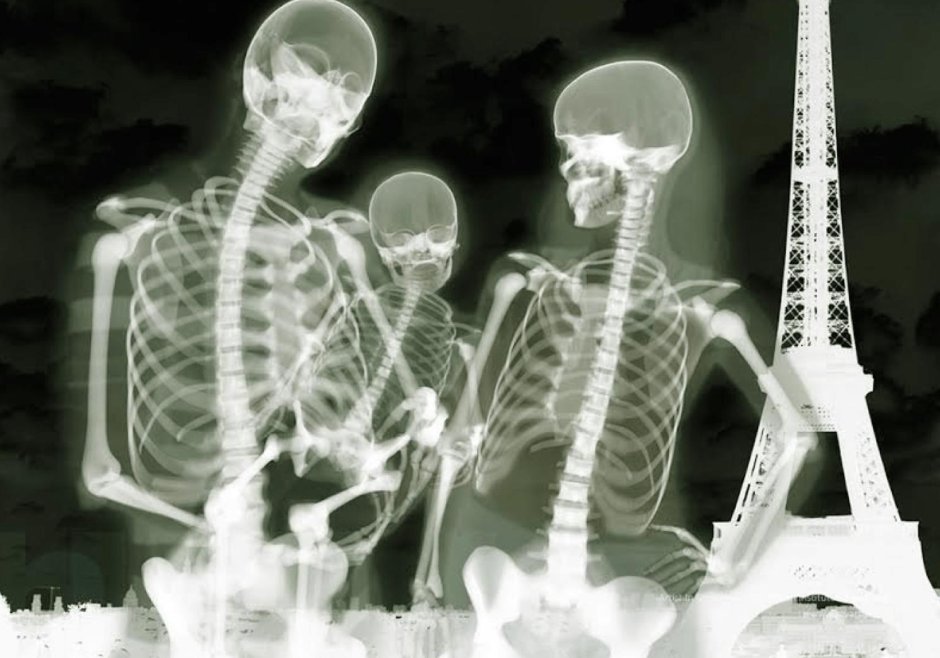Рентген скелета человека