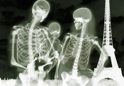 Рентген скелета человека