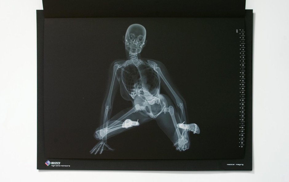 Рентген женщины