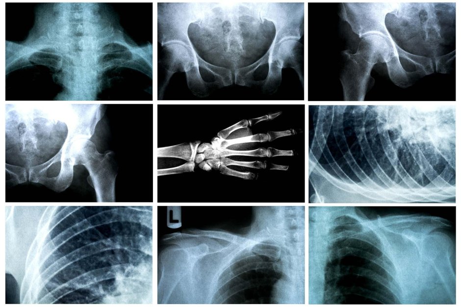 Рентгеновские снимки коллаж
