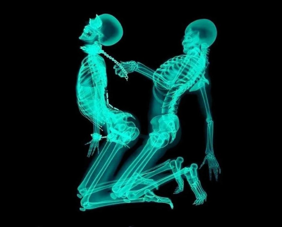 Секс в рентгене