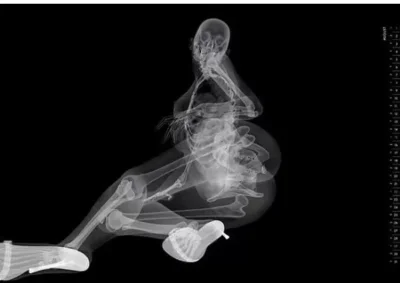 Рентген женщины