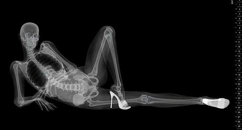 Скелет на рентгене