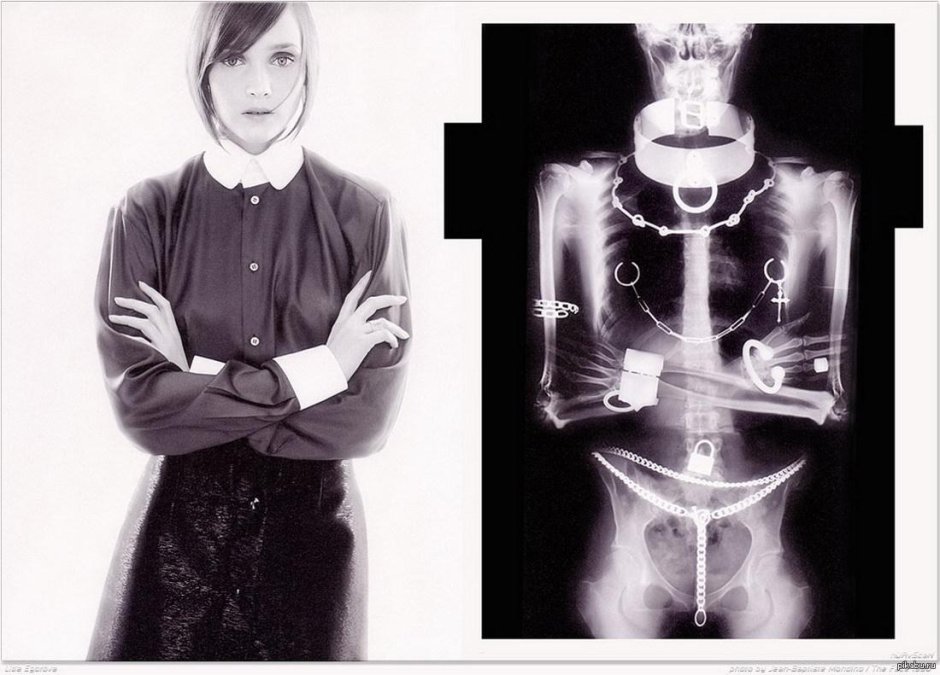 Рентген тела