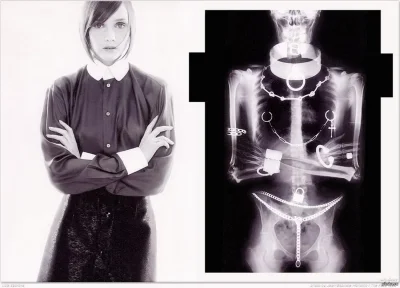 Рентген тела