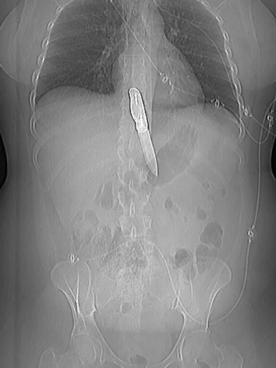 Рентгеновские снимки