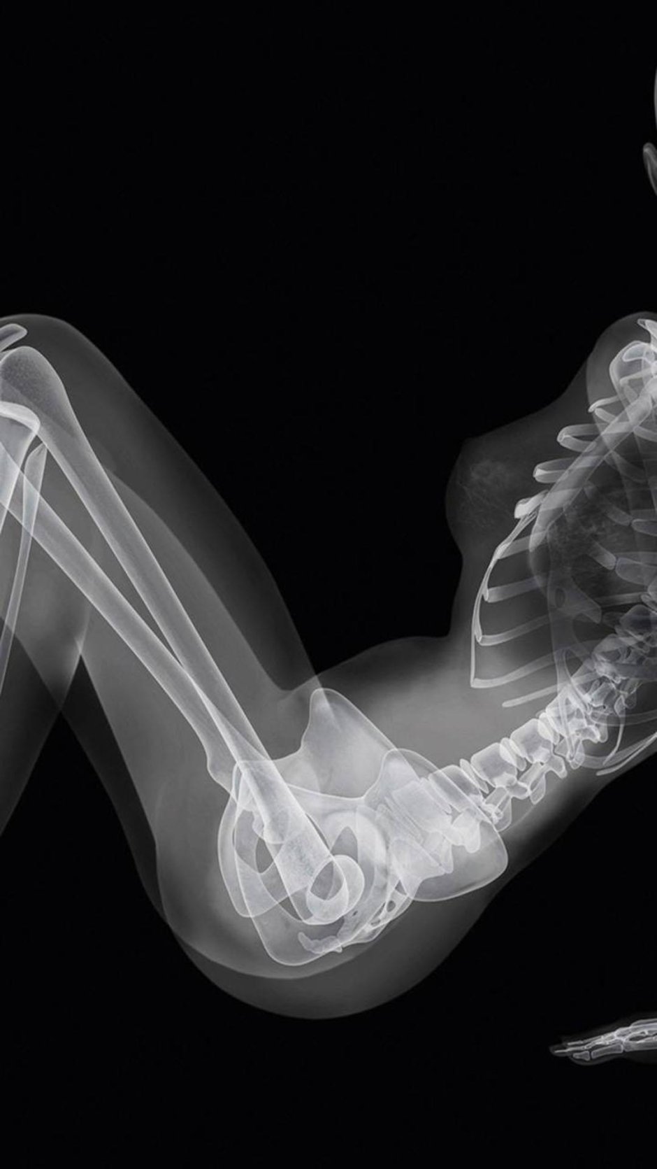 Ник визи рентген