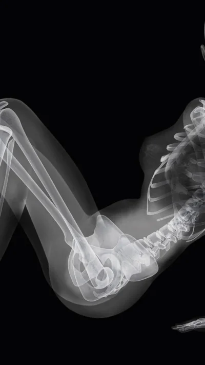 Ник визи рентген