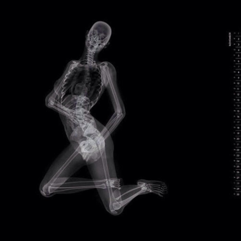 Рентген женщины