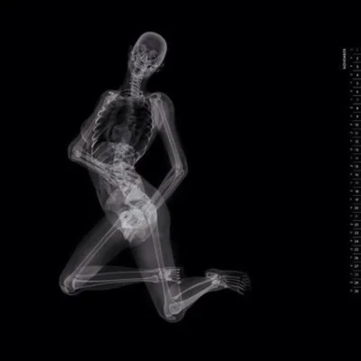 Рентген женщины