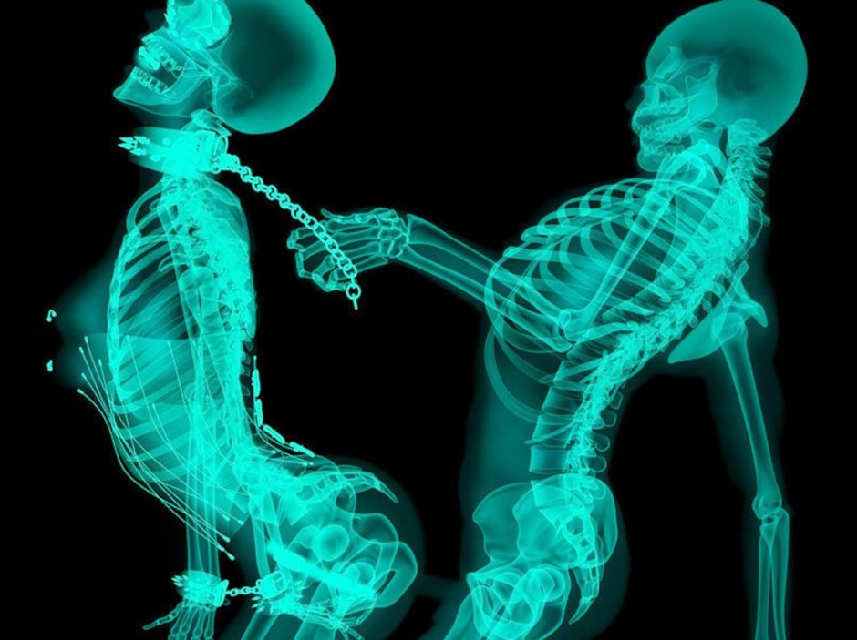 Рентгеновские снимки