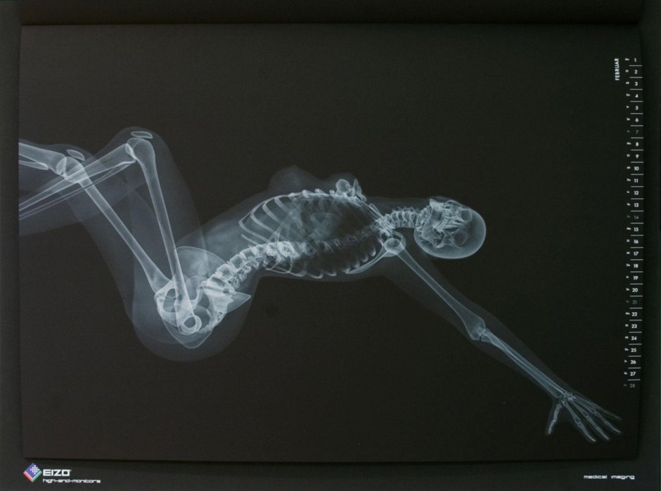 Рентген женщины