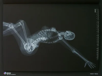 Рентген женщины