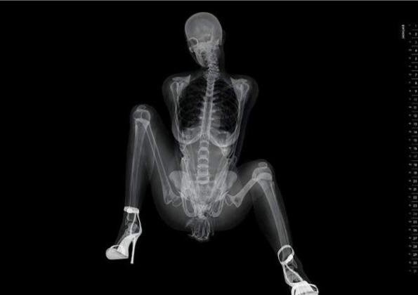 Рентгеновские снимки женщин