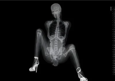 Рентгеновские снимки женщин