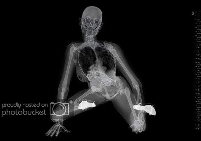 Скелет на рентгене