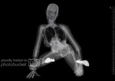 Скелет на рентгене