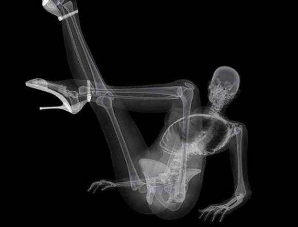 Рентгеновские снимки