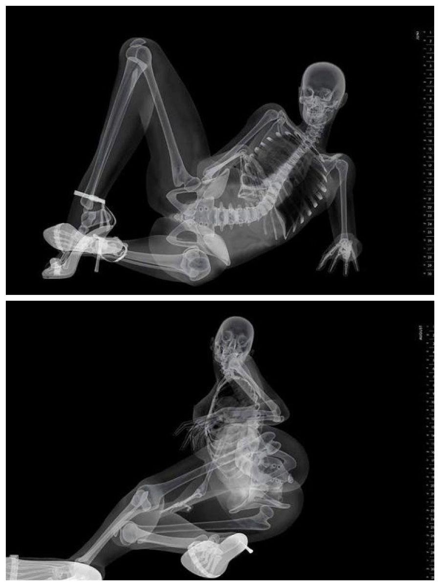 Рентгеновские снимки женщин