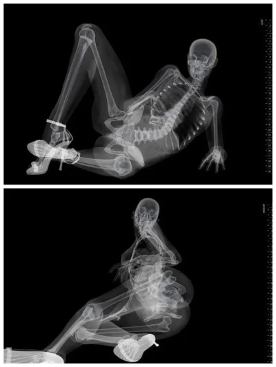 Рентгеновские снимки женщин