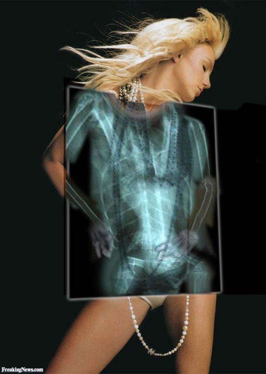 Женщины под рентгеном