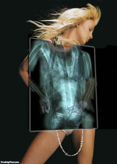 Женщины под рентгеном