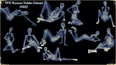 Рентгеновский снимок человека