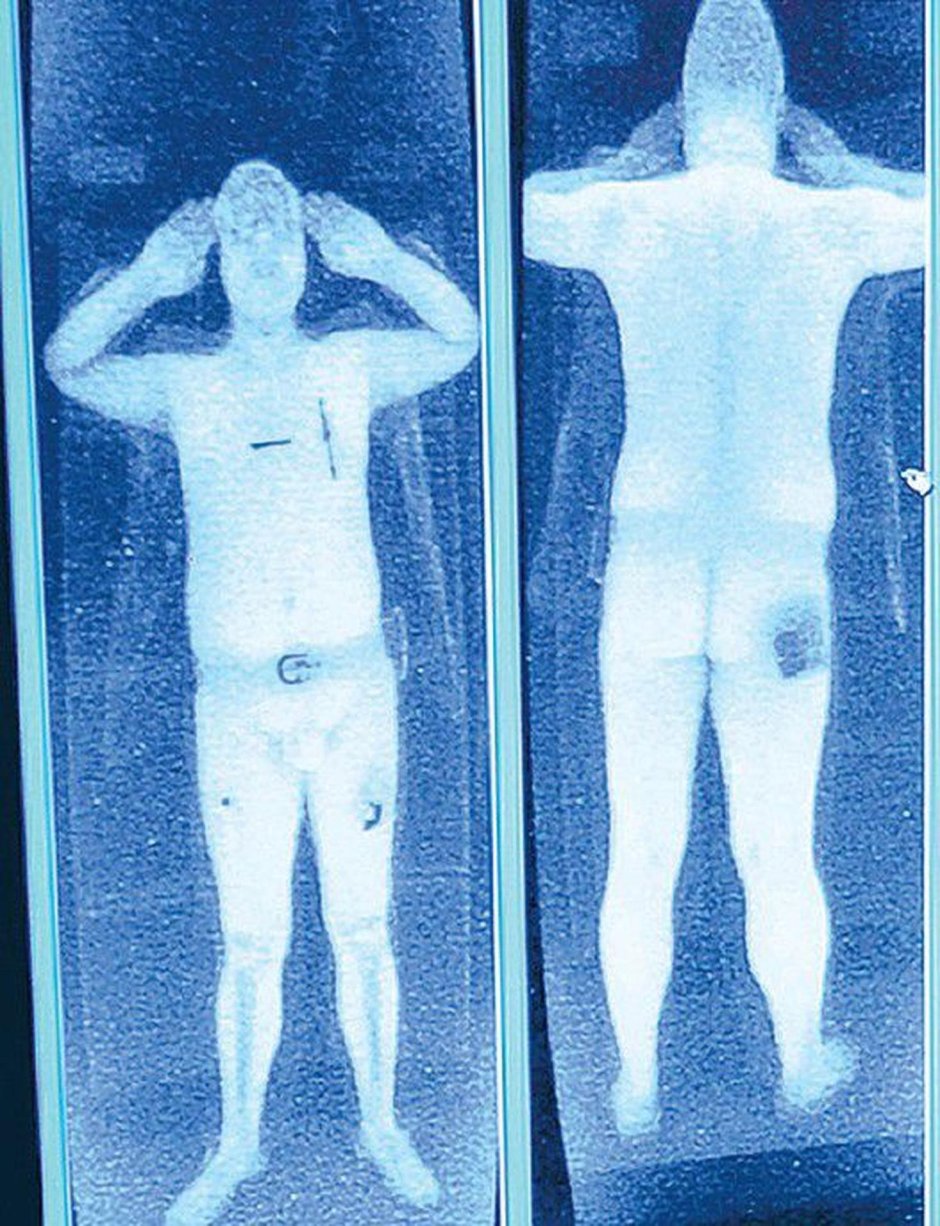 Рентгеновский сканер в аэропорту снимки